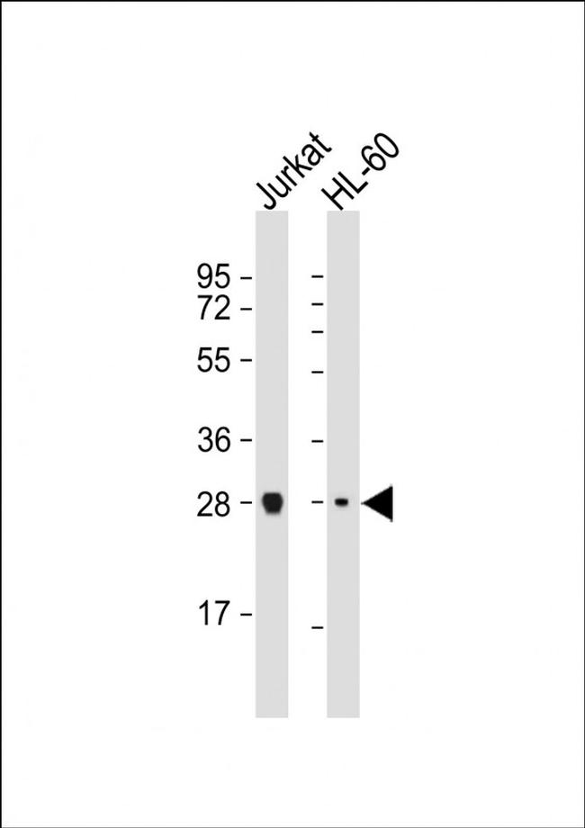 IMPA1 Antibody in Western Blot (WB)