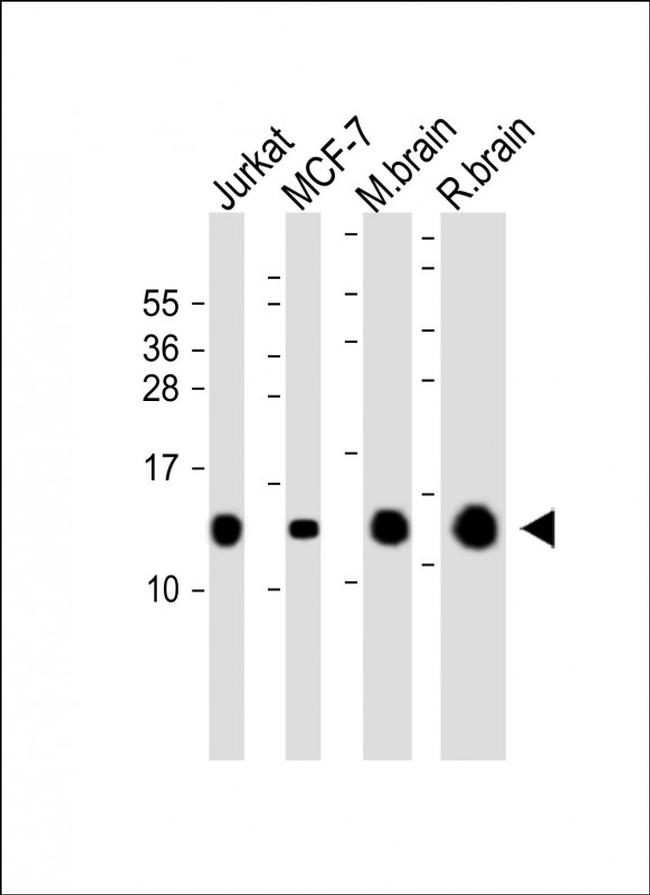 FKBP12 Antibody in Western Blot (WB)