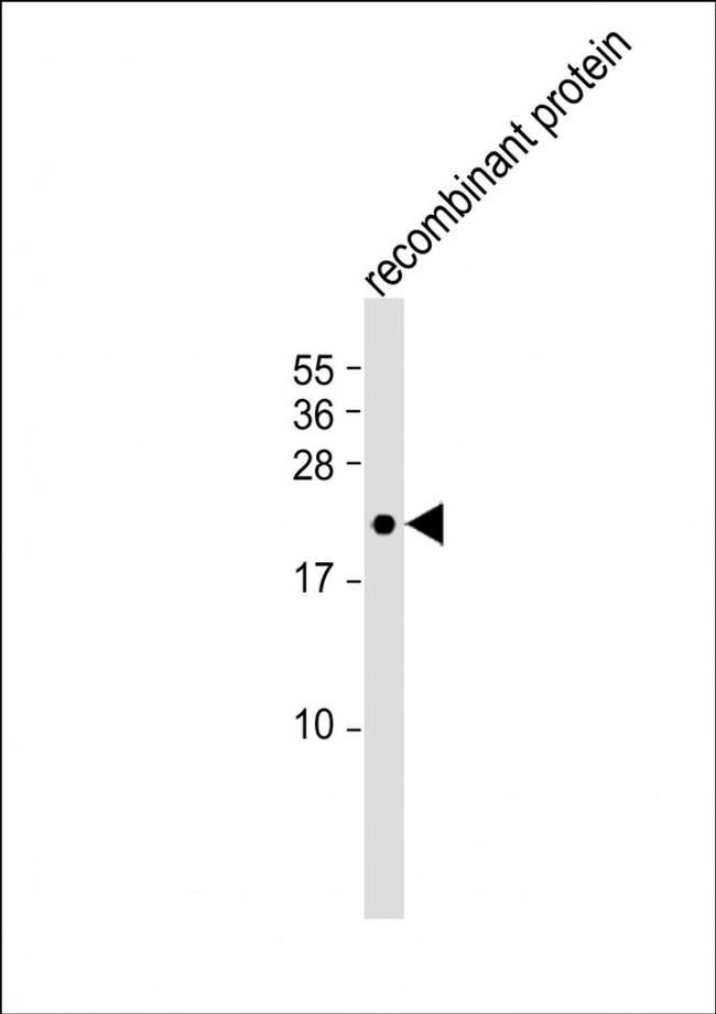 FGF4 Antibody in Western Blot (WB)