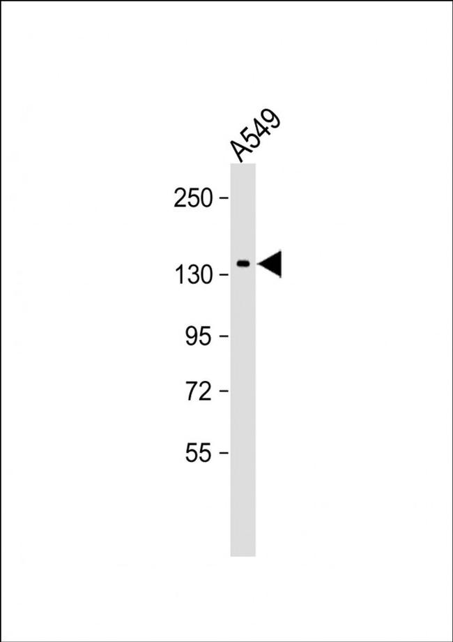 DAPK1 Antibody in Western Blot (WB)