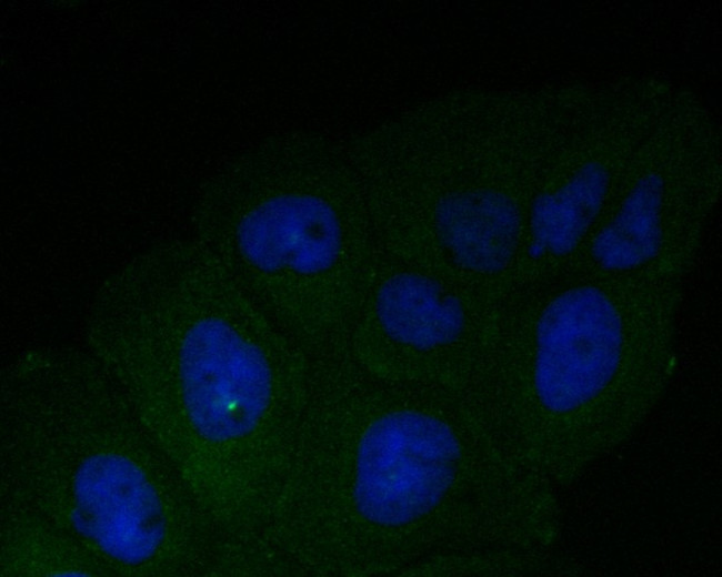 DFNA5 Antibody in Immunocytochemistry (ICC/IF)