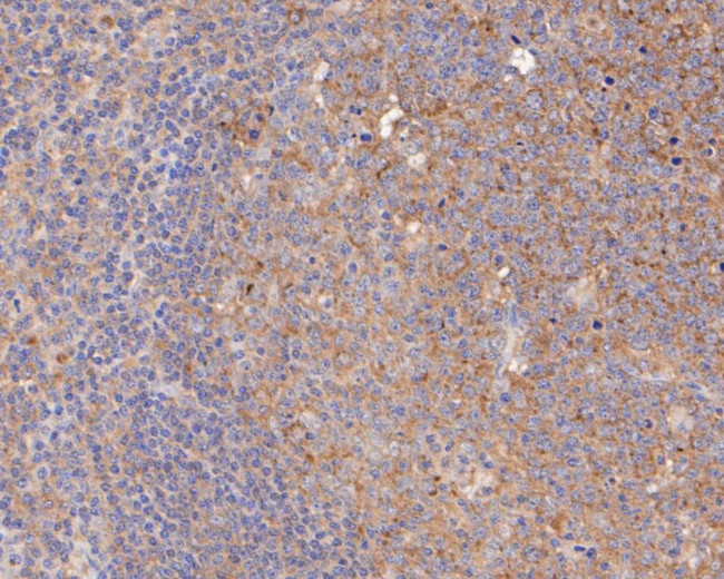 NFkB p52/p100 Antibody in Immunohistochemistry (Paraffin) (IHC (P))