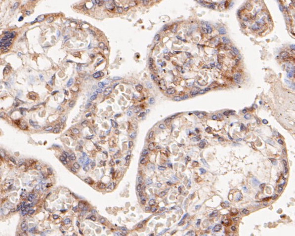 NFkB p52/p100 Antibody in Immunohistochemistry (Paraffin) (IHC (P))