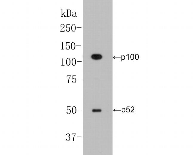 NFkB p52/p100 Antibody in Western Blot (WB)