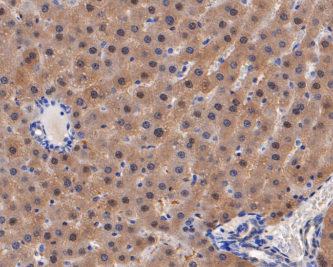 Aminoacylase Antibody in Immunohistochemistry (Paraffin) (IHC (P))