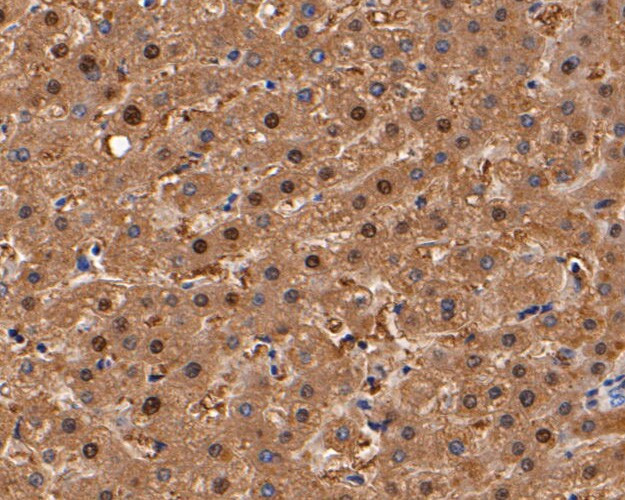 Aminoacylase Antibody in Immunohistochemistry (Paraffin) (IHC (P))