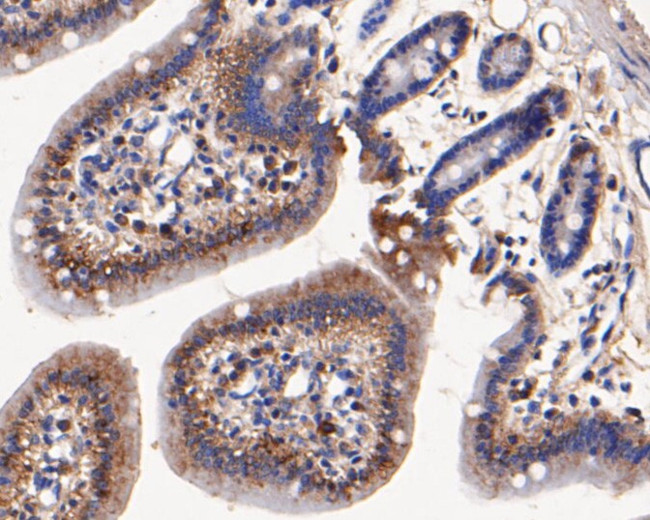 Aminoacylase Antibody in Immunohistochemistry (Paraffin) (IHC (P))