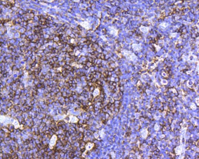 CD45 Antibody in Immunohistochemistry (Paraffin) (IHC (P))