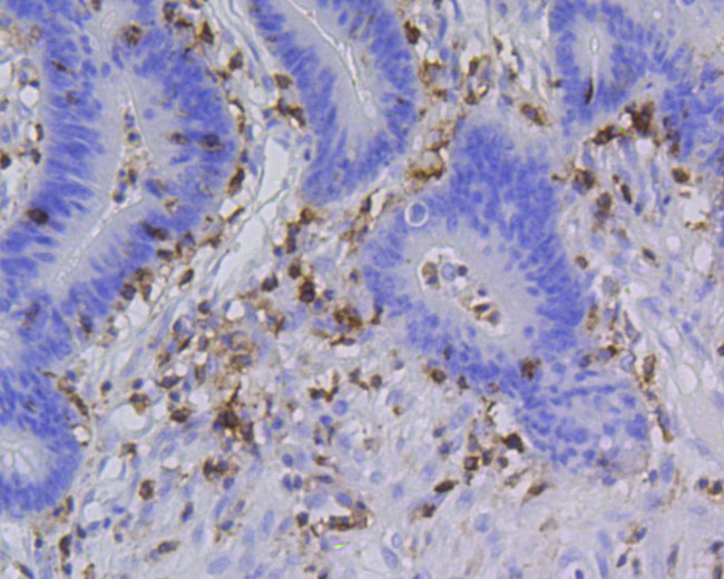 CD45 Antibody in Immunohistochemistry (Paraffin) (IHC (P))