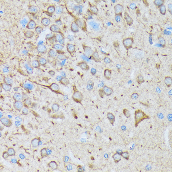 CaMKII Pan Antibody in Immunohistochemistry (Paraffin) (IHC (P))