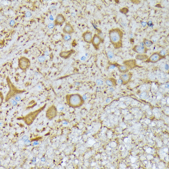 CaMKII Pan Antibody in Immunohistochemistry (Paraffin) (IHC (P))