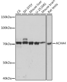 CHRNA4 Antibody in Western Blot (WB)