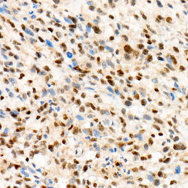 TFE3 Antibody in Immunohistochemistry (Paraffin) (IHC (P))