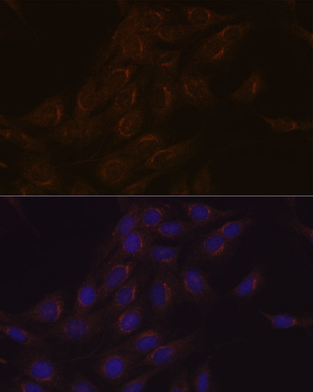 PIST Antibody in Immunocytochemistry (ICC/IF)