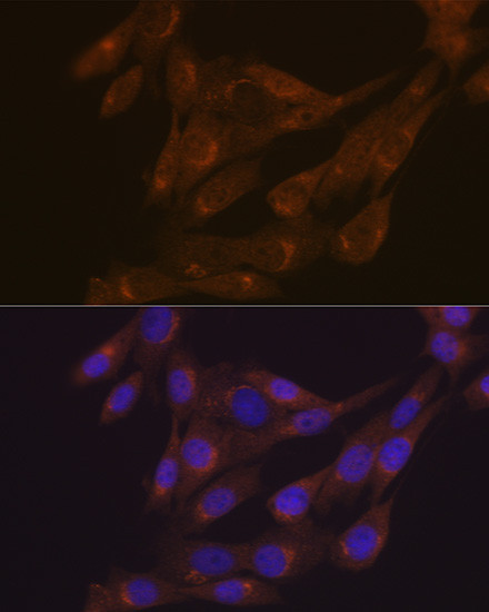 PIST Antibody in Immunocytochemistry (ICC/IF)