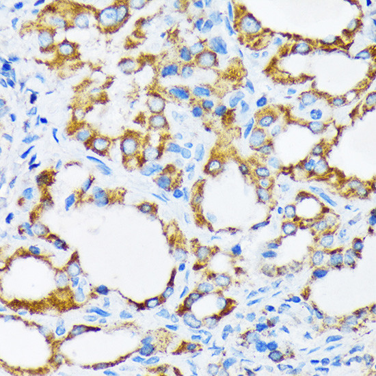 PIST Antibody in Immunohistochemistry (Paraffin) (IHC (P))