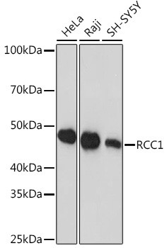 RCC1 Antibody in Western Blot (WB)