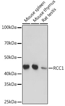 RCC1 Antibody in Western Blot (WB)