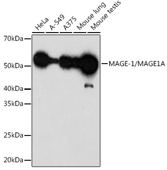 MAGE1 Antibody in Western Blot (WB)