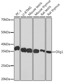 OLIG1 Antibody in Western Blot (WB)