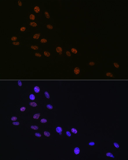 MATR3 Antibody in Immunocytochemistry (ICC/IF)