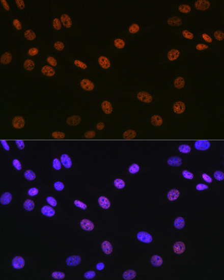 MATR3 Antibody in Immunocytochemistry (ICC/IF)