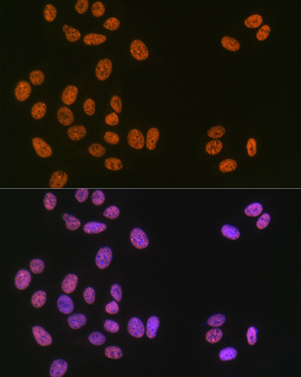 MATR3 Antibody in Immunocytochemistry (ICC/IF)