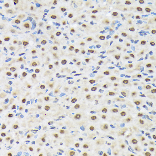 MATR3 Antibody in Immunohistochemistry (Paraffin) (IHC (P))