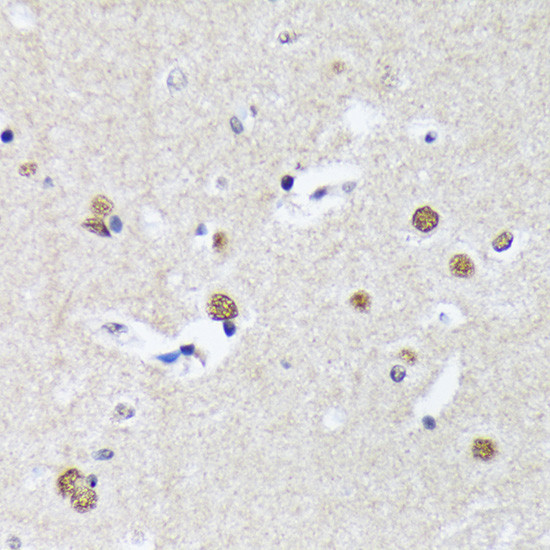 MATR3 Antibody in Immunohistochemistry (Paraffin) (IHC (P))