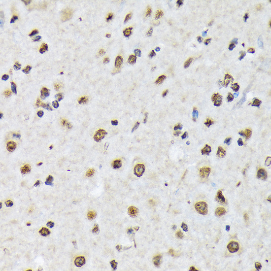 MATR3 Antibody in Immunohistochemistry (Paraffin) (IHC (P))