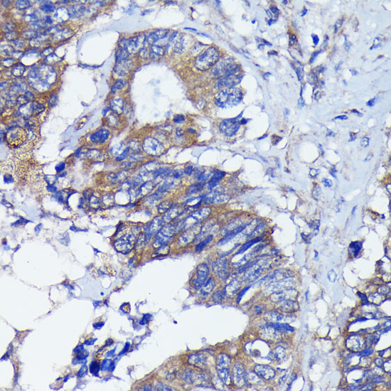 PKC alpha Antibody in Immunohistochemistry (Paraffin) (IHC (P))