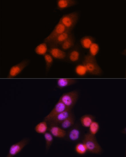 p16INK4a Antibody in Immunocytochemistry (ICC/IF)