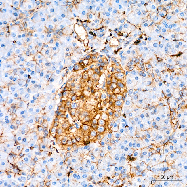 GLUT1 Antibody in Immunohistochemistry (Paraffin) (IHC (P))