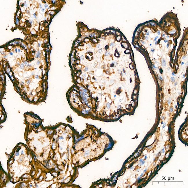 GLUT1 Antibody in Immunohistochemistry (Paraffin) (IHC (P))