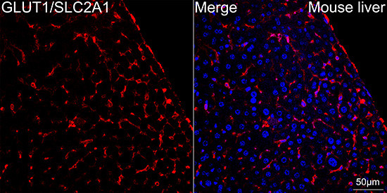 GLUT1 Antibody in Immunohistochemistry (Paraffin) (IHC (P))