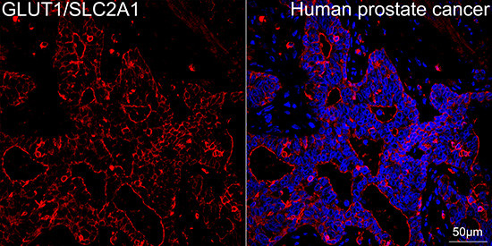 GLUT1 Antibody in Immunohistochemistry (Paraffin) (IHC (P))