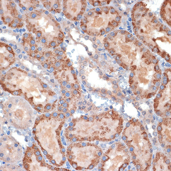 TIMM50 Antibody in Immunohistochemistry (Paraffin) (IHC (P))