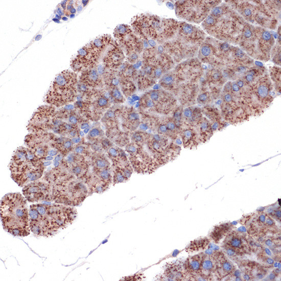 TIMM50 Antibody in Immunohistochemistry (Paraffin) (IHC (P))