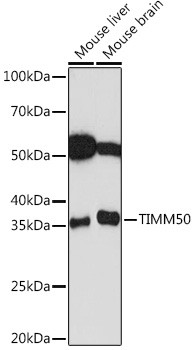 TIMM50 Antibody in Western Blot (WB)