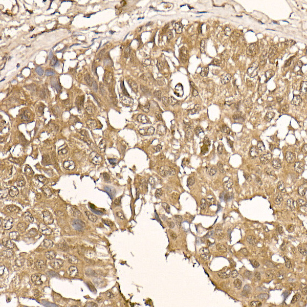 AKT1 Antibody in Immunohistochemistry (Paraffin) (IHC (P))