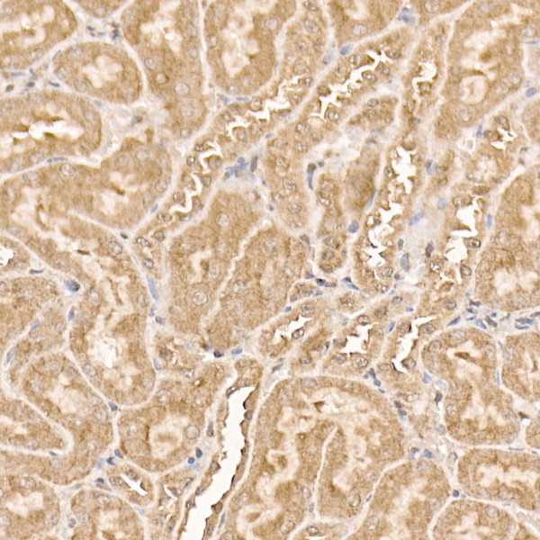 AKT1 Antibody in Immunohistochemistry (Paraffin) (IHC (P))