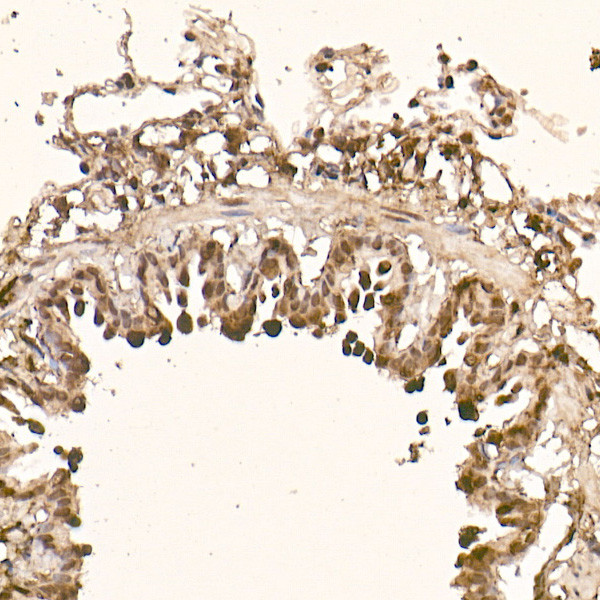 AKT1 Antibody in Immunohistochemistry (Paraffin) (IHC (P))