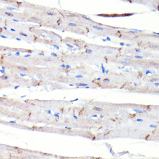 N-cadherin Antibody in Immunohistochemistry (Paraffin) (IHC (P))