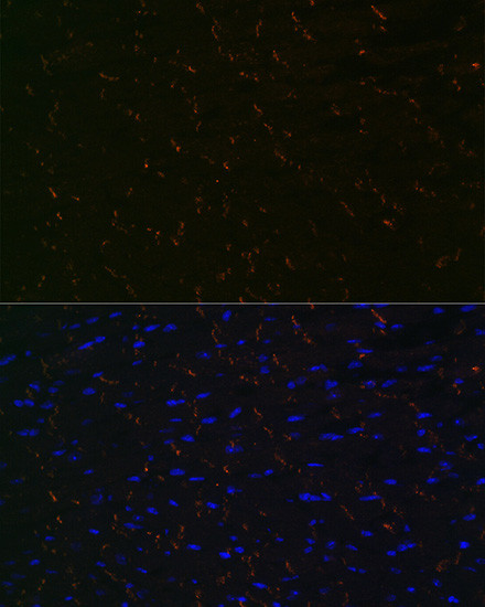 N-cadherin Antibody in Immunohistochemistry (Paraffin) (IHC (P))