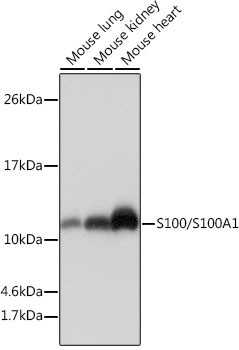 S100A1 Antibody in Western Blot (WB)