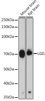 LGI1 Antibody in Western Blot (WB)