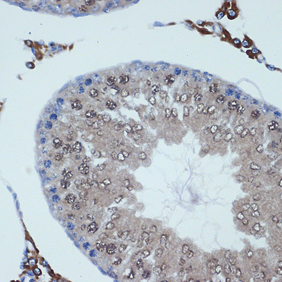 RANBP9 Antibody in Immunohistochemistry (Paraffin) (IHC (P))