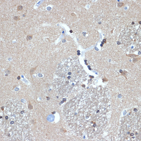 RANBP9 Antibody in Immunohistochemistry (Paraffin) (IHC (P))