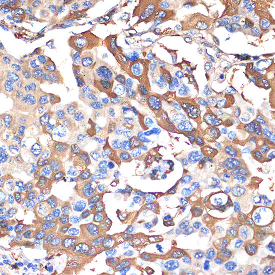 VPS28 Antibody in Immunohistochemistry (Paraffin) (IHC (P))