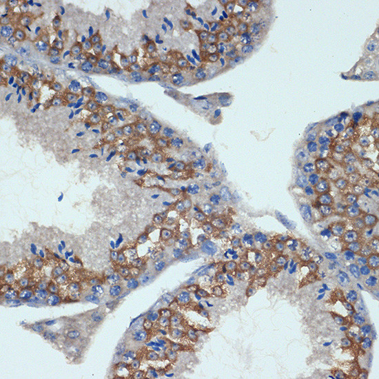 CHMP2B Antibody in Immunohistochemistry (Paraffin) (IHC (P))